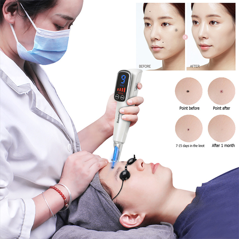 # Profesyonel Lazer Pikosaniye - Picosecond Laser Freckle Mole Remover incelemesi ve fiyatı