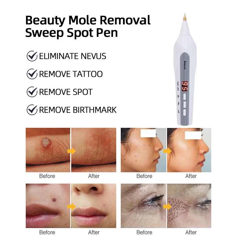 Güzellik İçin Kullanılan Leke  - Plasma Mole Spot Removal Pen 9 Level incelemesi ve fiyatı
