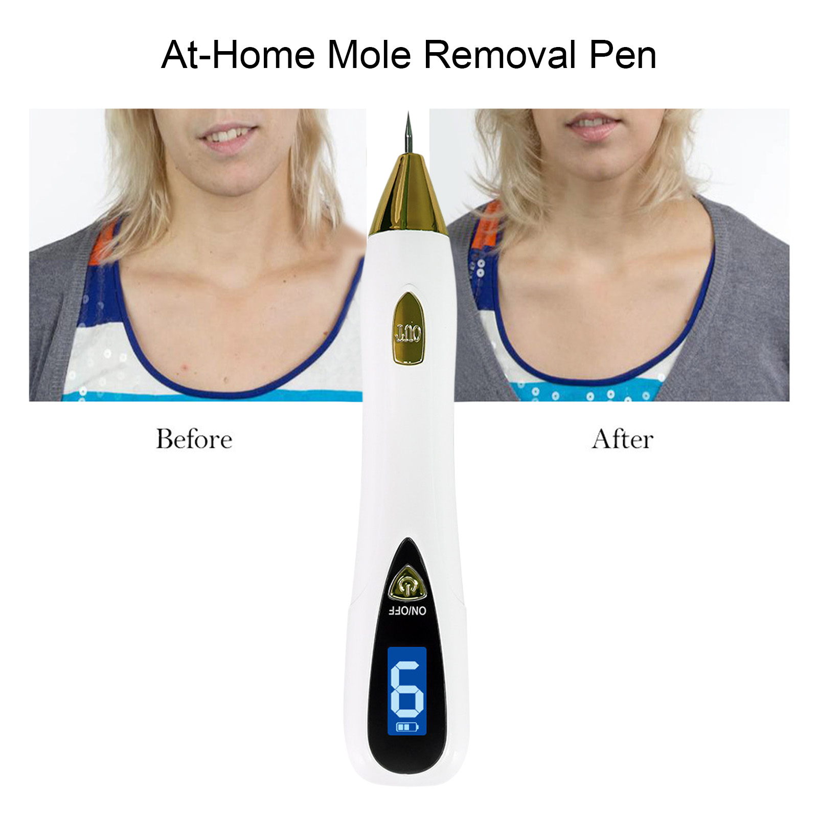 9 Seviyeli Profesyonel Siğil v - Plasma Mole Spot Removal Pen 9 Level incelemesi ve fiyatı