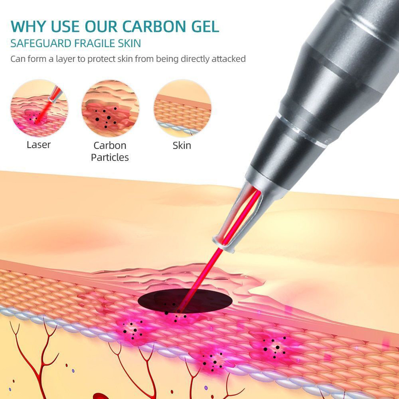 10 adet 5 adet 2 adet 1 adet g - Laser Carbon Peel Cream Gel 80Ml incelemesi ve fiyatı